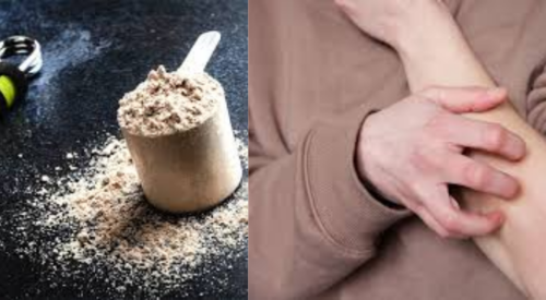 Why Does Beta Alanine Make You Itch