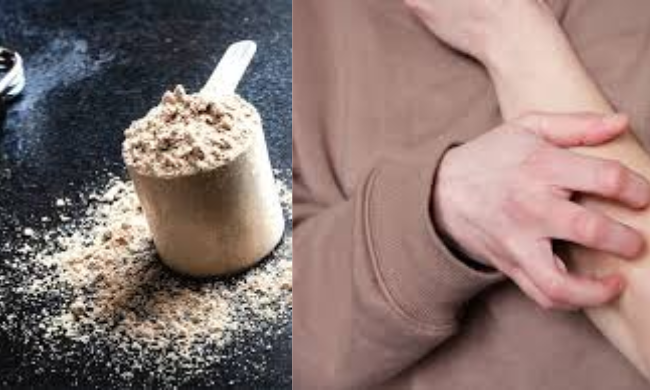 Why Does Beta Alanine Make You Itch
